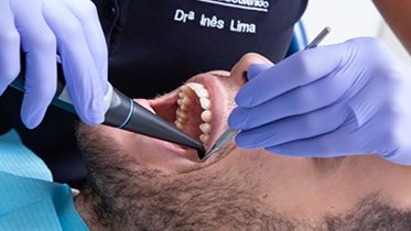 A Endodontia trata a polpa dentária e todo o sistema de canais radiculares e dos tecidos periapicais, para que o dente fique “sem vida”.  