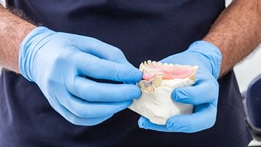 São estruturas que permitem a substituição de dentes, proporcionando o restabelecimento da função estética, fonética e mastigatória.